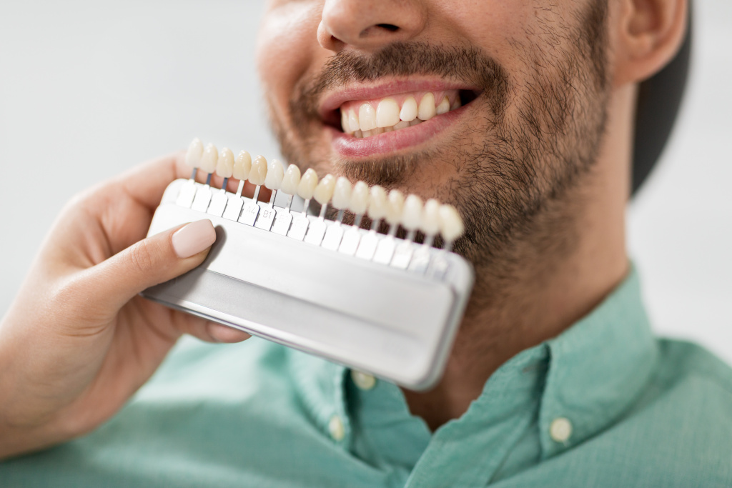 Флюороз зубов — причины и симптомы | Диагностика и лечение флюороза в «СМ-Стоматология»